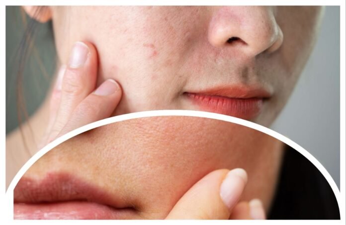 त्वचेची, अवांतर, मराठीकथा, मराठीलेखक, मराठीसाहित्य, Skin, DrySkin, OilySkin, कोरडीत्वचा, तेलकटत्वचा